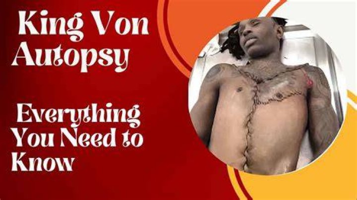 The Definitive Guide To Rappers Autopsy: Uncovering The Truth Behind The Lyrics