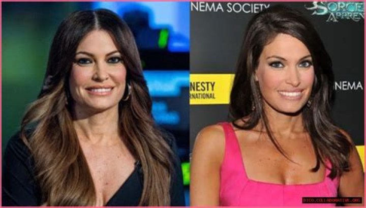 Transformative Journey: Kimberly Guilfoyle Before And After Pictures